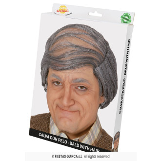 Plešina s prehadzovačkou