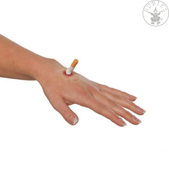 Popálenina cigaretou